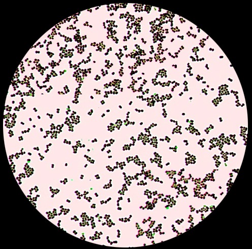 Pediococcus acidilactici - Sức mạnh của vi khuẩn probiotic trong thủy sản 4 pediococcus-acidilactici-suc-manh-cua-vi-khuan-probiotic-trong-nuoi-trong-thuy-san
