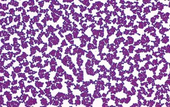 Pediococcus acidilactici - Sức mạnh của vi khuẩn probiotic trong thủy sản 3 pediococcus-acidilactici-suc-manh-cua-vi-khuan-probiotic-trong-nuoi-trong-thuy-san