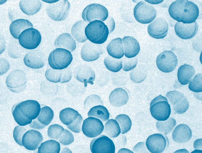 Pediococcus acidilactici - Sức mạnh của vi khuẩn probiotic trong thủy sản 2 pediococcus-acidilactici-suc-manh-cua-vi-khuan-probiotic-trong-nuoi-trong-thuy-san