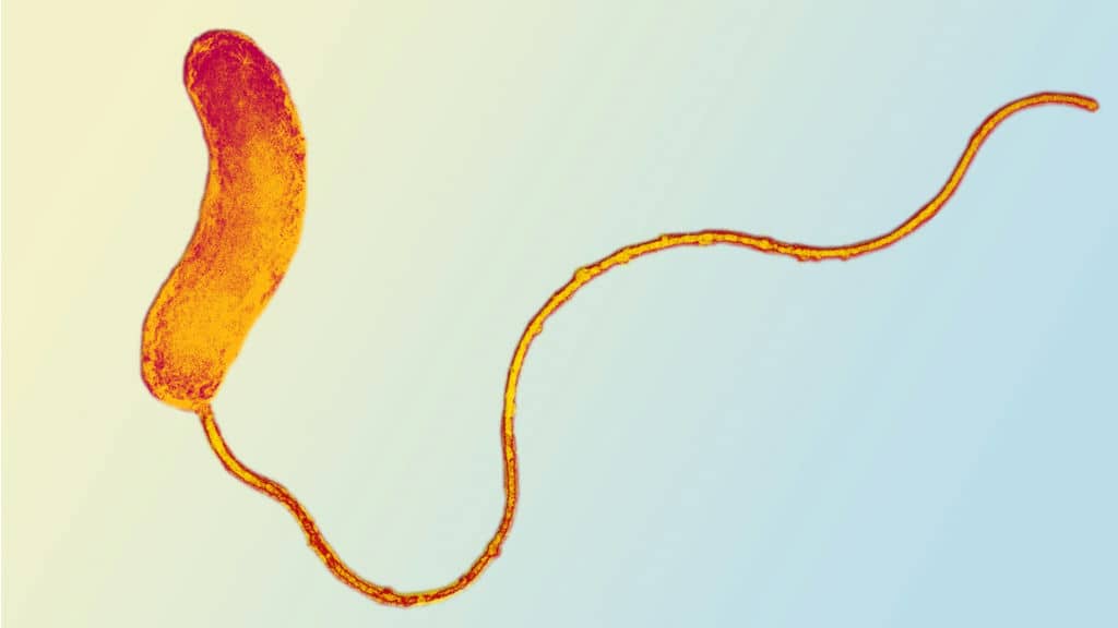 Bdellovibrio | Vi khuẩn ăn vi khuẩn trong thủy sản 1 bdellovibrio-vi-khuan-an-vi-khuan-trong-thuy-san